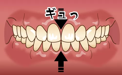 上下の歯いつもさわってない？