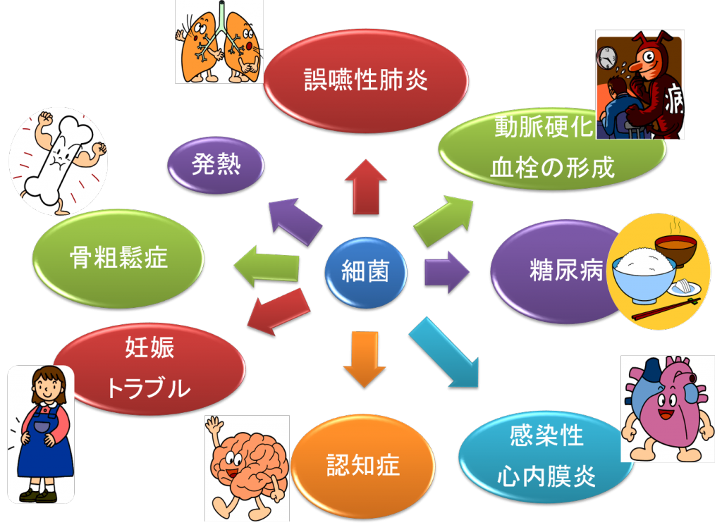歯周病は万病のもと